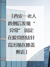 西安一老人跌倒后发现“异常” 固定在股骨的钛针竟出现在膝盖附近